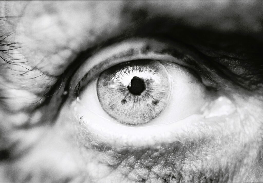 What Is Glaucoma and How Early Can It Be Detected?